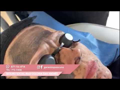 Génesis Plus: Hollywood peel