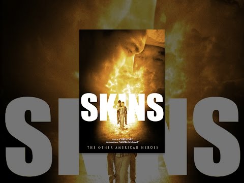 Skins